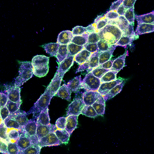 Confocal microscopy image of cancer cells used in biomarker research