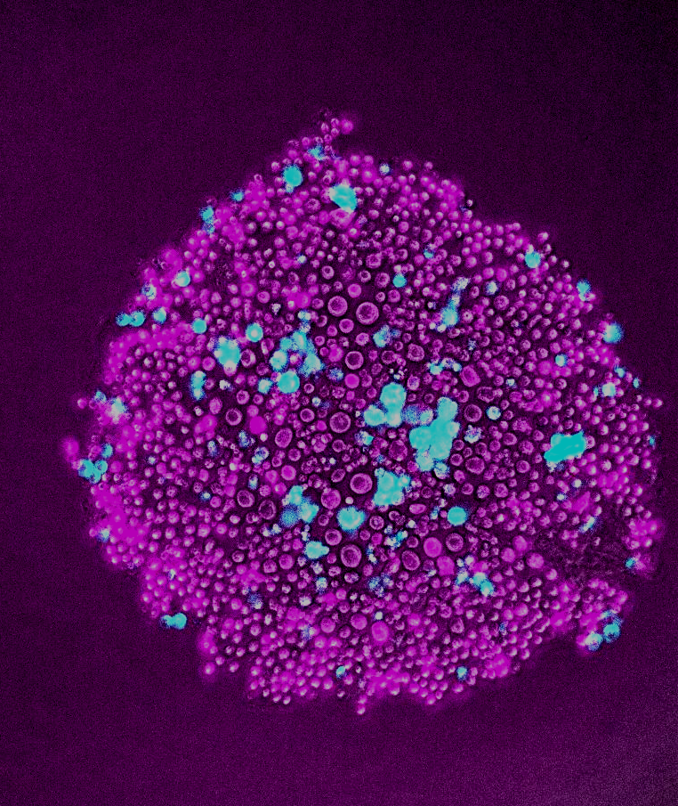Confocal microscopy image of a cell spheroid used to study collective migration and invasion
